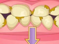 Játék Bad Teeth Makeover online