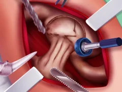 Játék Princess Hips Surgery online