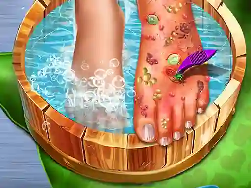 Játék Feet Skin Doctor online
